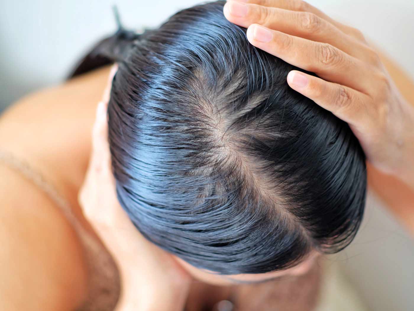 Hair: How to get rid of Oily Hair without Washing - Pure Sense