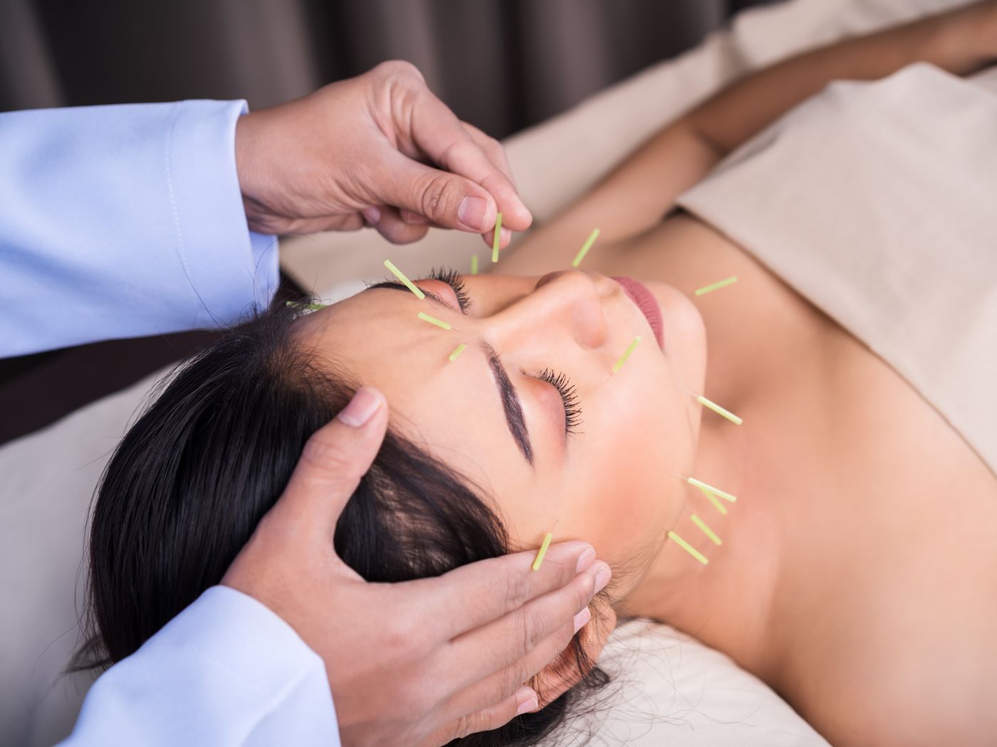 A Complete Guide To Facial Acupuncture