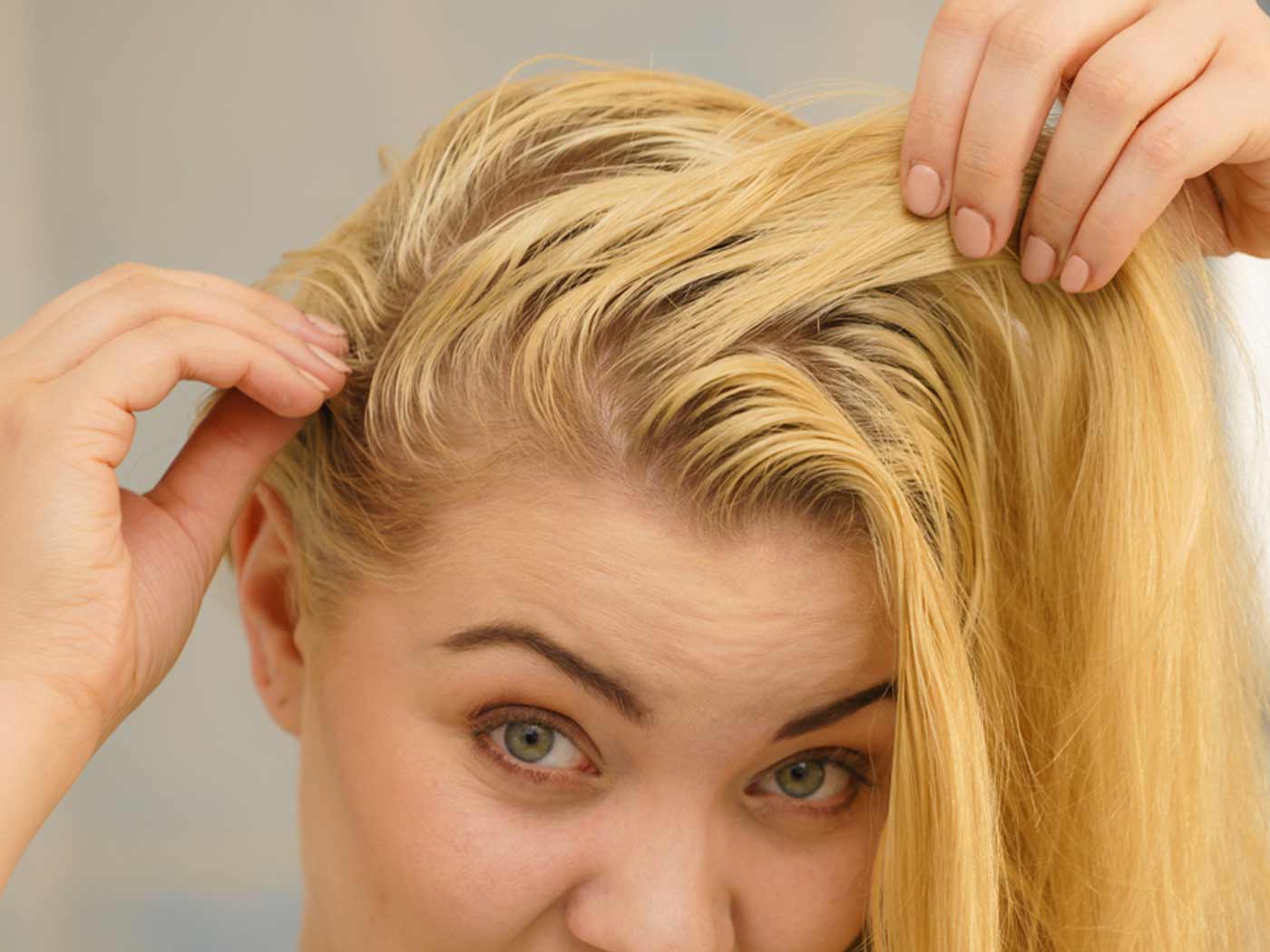 treatment for oily scalp