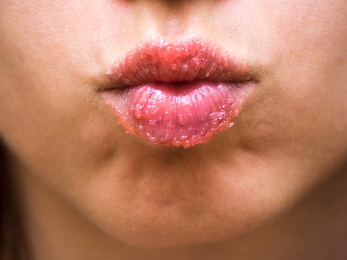 How to exfoliate lips