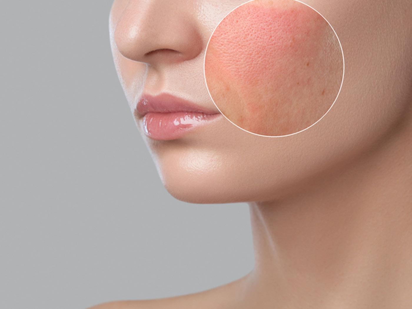 Face Redness: Causes and How to Reduce It?