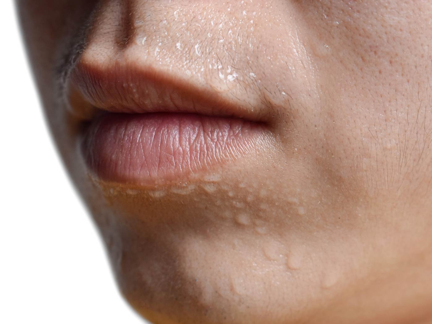 How to control facial sweat